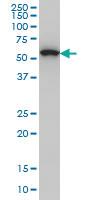 Anti-OXSR1 Mouse Monoclonal Antibody [clone: 3A8]