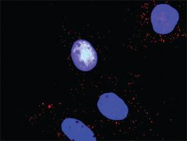 Anti-PTK2 + YES1 Antibody Pair