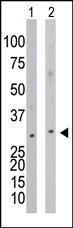 Anti-NAGK Rabbit Polyclonal Antibody (HRP (Horseradish Peroxidase))