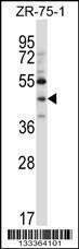 Anti-NEUROD6 Rabbit Polyclonal Antibody (APC (Allophycocyanin))