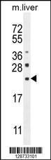 Anti-CLEC2L Rabbit Polyclonal Antibody (APC (Allophycocyanin))