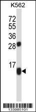 Anti-MPC2 Rabbit Polyclonal Antibody (FITC (Fluorescein Isothiocyanate))