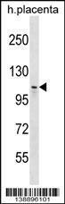 Anti-MMS19 Rabbit Polyclonal Antibody (APC (Allophycocyanin))