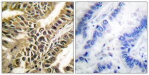 Antibody anti-ABL A99489-100 100 µg