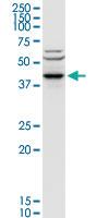 Anti-ACY1 Rabbit Polyclonal Antibody