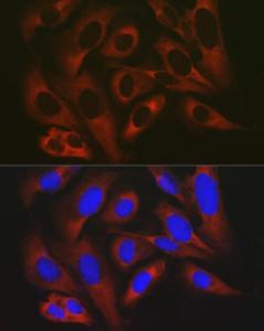 Immunofluorescence analysis of U2OS cells using Anti-RPL19 Antibody (A307804) at a dilution of 1:200 (40X lens). DAPI was used to stain the cell nuclei (blue)