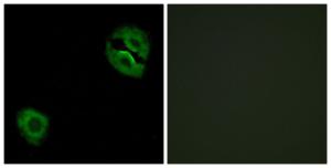 Immunofluorescence analysis of A549 cells using Anti-Collagen XIX alpha1 Antibody. The right hand panel represents a negative control, where the antibody was pre-incubated with the immunising peptide.