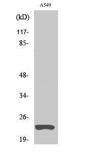 Western blot analysis of A549 cells using Anti-MAD2L1 Antibody