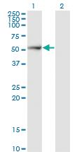 Anti-PSMD5 Mouse Monoclonal Antibody [clone: 1H7]