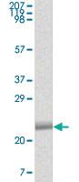 Anti-EPHB4 Mouse Monoclonal Antibody [clone: 5B8F7]