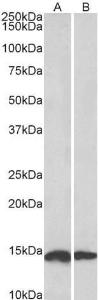 Anti-NDUFS6 Antibody (A84752) (0.1 µg/ml) staining of Mouse (A) and Rat (B) Heart lysates (35 µg protein in RIPA buffer). Primary incubation was 1 hour. Detected by chemiluminescence