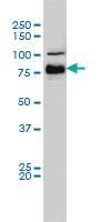 Anti-BRAF Mouse Monoclonal Antibody [clone: 3C6]