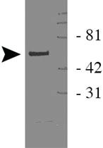 Anti-WWTR1 Rabbit Polyclonal Antibody