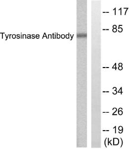 Western blot analysis of lysates from COS7 cells, treated with UV 30' using Anti-Tyrosinase Antibody The right hand lane represents a negative control, where the antibody is blocked by the immunising peptide