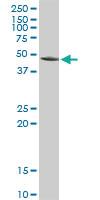 Anti-ACY1 Rabbit Polyclonal Antibody