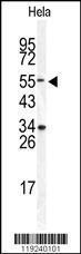 Anti-DONSON Rabbit Polyclonal Antibody