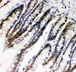 Anti-HIF-1-Alpha Polyclonal Antibody