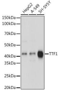 Anti-TTF1 Rabbit Monoclonal Antibody [clone: ARC1942]