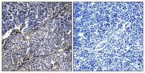 Immunohistochemical analysis of paraffin-embedded human thymus gland tissue using Anti-Collagen XIX alpha1 Antibody. The right hand panel represents a negative control, where the antibody was pre-incubated with the immunising peptide.