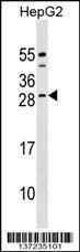 Anti-CABP4 Rabbit Polyclonal Antibody (AP (Alkaline Phosphatase))