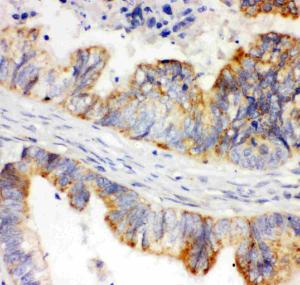 Anti-HIF-1-Alpha Polyclonal Antibody