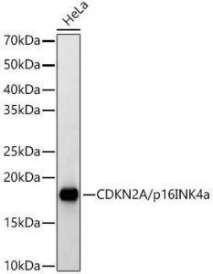 Antibody anti-CDKN2A 100 µl