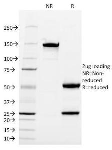 SDS-PAGE analysis of Anti-CD13 Antibody [WM15] under non-reduced and reduced conditions; showing intact IgG and intact heavy and light chains, respectively. SDS-PAGE analysis confirms the integrity and purity of the antibody