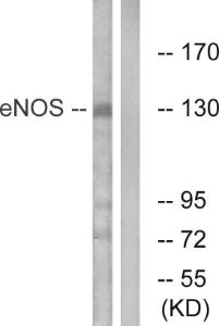 Western blot analysis of lysates from Jurkat cells using Anti-eNOS Antibody. The right hand lane represents a negative control, where the antibody is blocked by the immunising peptide