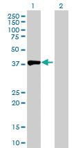 Anti-ACY1 Rabbit Polyclonal Antibody