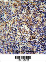 Anti-CASKIN2 Rabbit Polyclonal Antibody