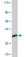 Anti-CNOT2 Mouse Monoclonal Antibody [clone: 3F1]