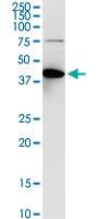 Anti-ACY1 Rabbit Polyclonal Antibody