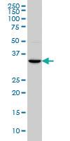 Anti-HOXC4 Mouse Monoclonal Antibody [clone: 1E9]