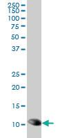 Anti-TXN Mouse Monoclonal Antibody [clone: 6C10]