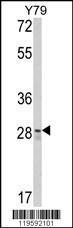 Anti-C10orf66 Rabbit Polyclonal Antibody