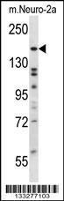 Anti-ATG2B Rabbit Polyclonal Antibody (HRP (Horseradish Peroxidase))