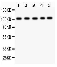 Anti-SLC4A1 Rabbit Polyclonal Antibody