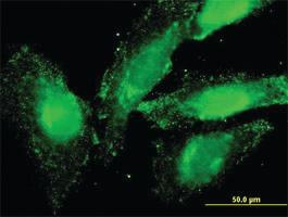 Anti-ELANE Mouse Monoclonal Antibody [clone: 4E11]