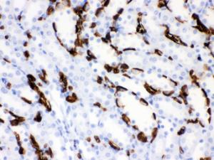 Anti-SLC4A1 Rabbit Polyclonal Antibody