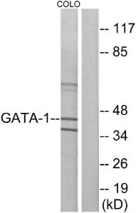 Anti-GATA1 Rabbit Polyclonal Antibody