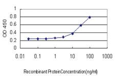 Anti-ELANE Mouse Monoclonal Antibody [clone: 4B11]