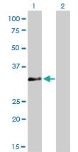 Anti-HOXC4 Mouse Monoclonal Antibody [clone: 1E9]