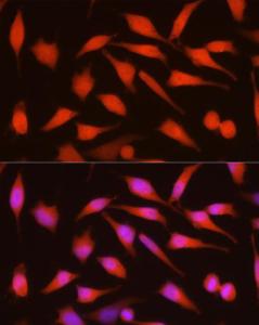 Antibody anti-CDKN2A 100 µl