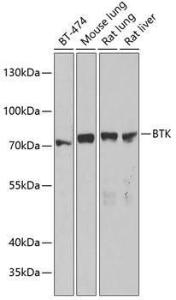 Anti-BTK antibody