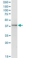 Anti-ACY1 Rabbit Polyclonal Antibody