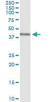 Anti-TRDMT1 Polyclonal Antibody Pair