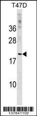 Anti-CLEC4D Rabbit Polyclonal Antibody (HRP (Horseradish Peroxidase))