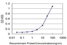 Anti-ELANE Mouse Monoclonal Antibody [clone: 3E5]