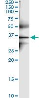 Anti-GPD1L Polyclonal Antibody Pair