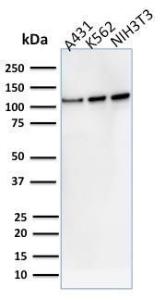 Western blot analysis of human A431, K562, and NIH3T3 cell lysates using Anti-Vinculin Antibody [VCL/2575]